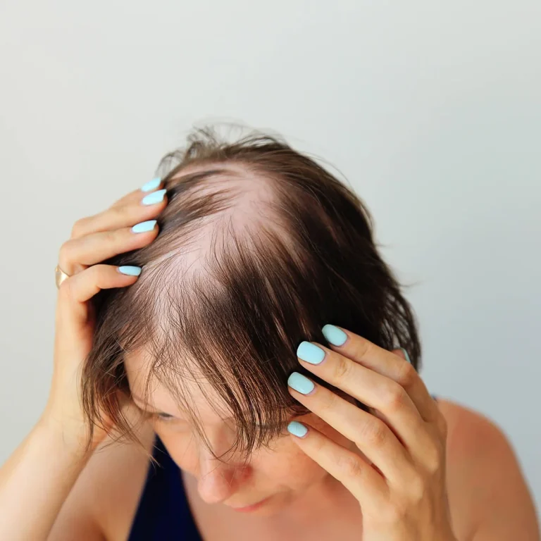 hair growth treatment 